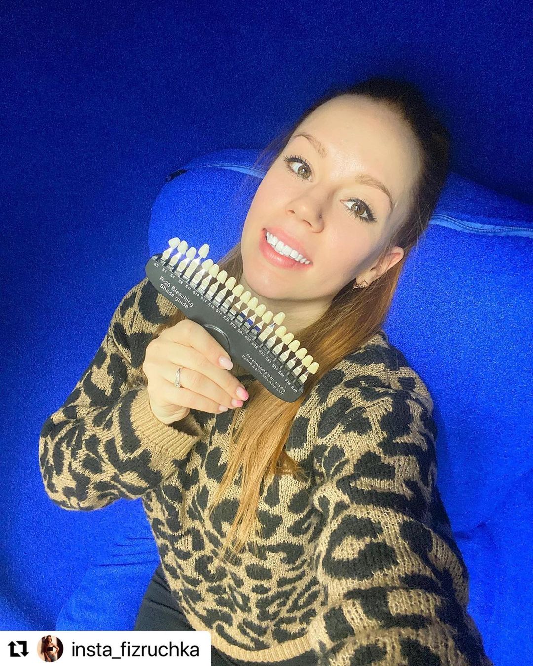 16 декабря 2020 отзыв на отбеливание зубов от @insta_fizruchka