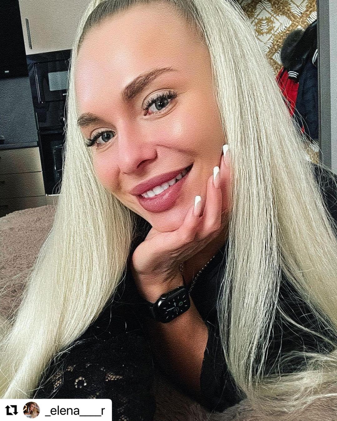 6 февраля 2021 отзыв на отбеливание зубов от @_elena____r