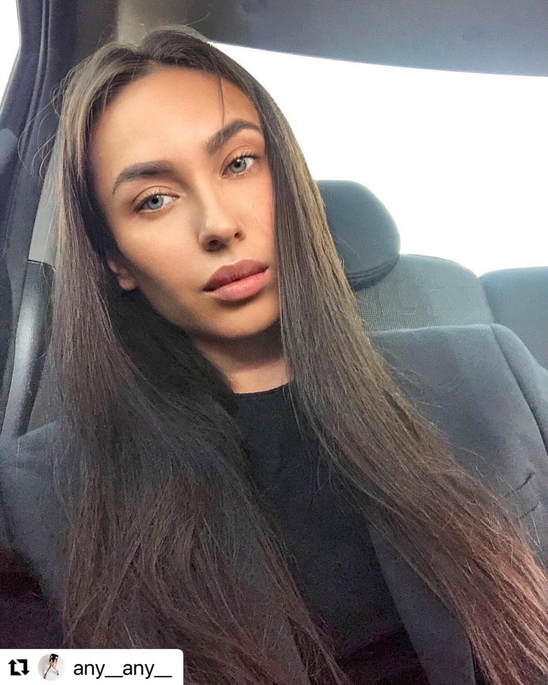 27 февраля 2021 отзыв на отбеливание зубов от @any__any__