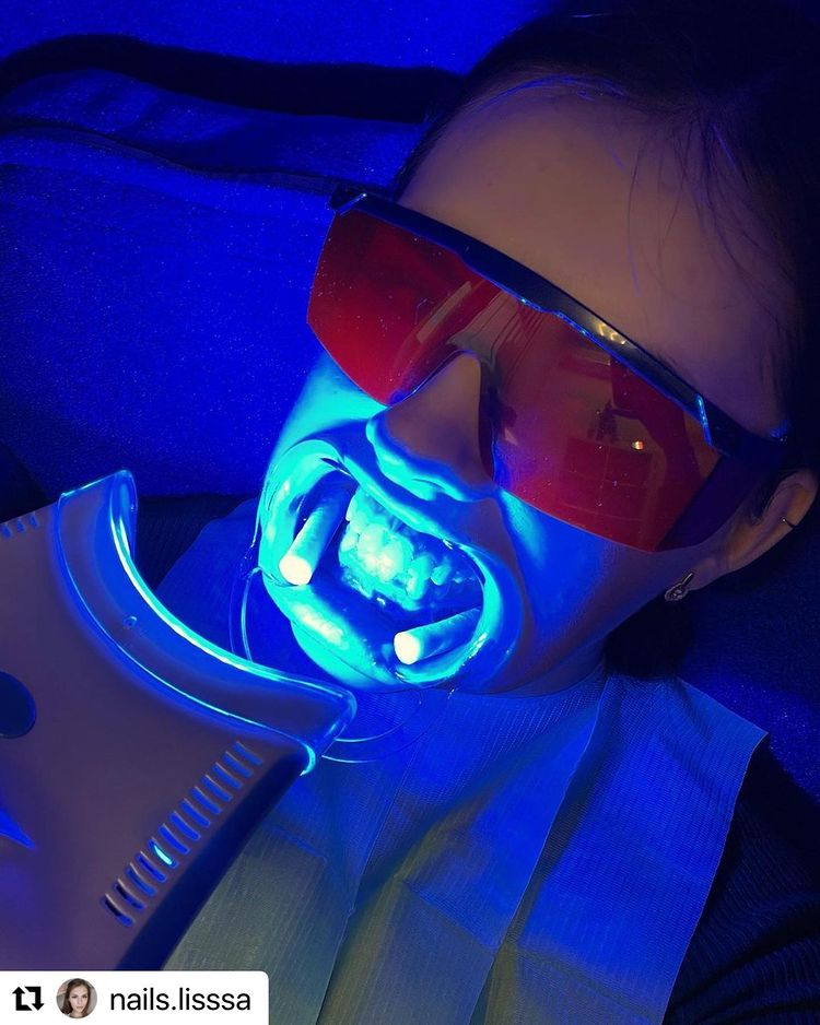 29 марта 2021 отзыв на отбеливание зубов от @nails.lisssa