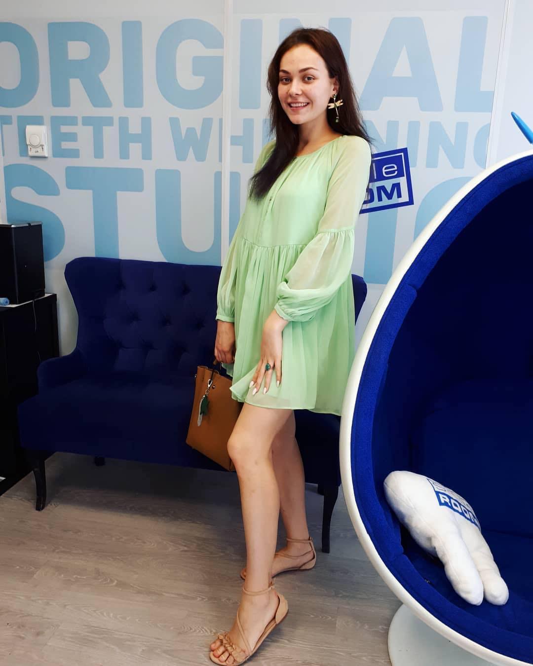 22 августа 2019 отзыв на отбеливание зубов от @kse_ni_aa