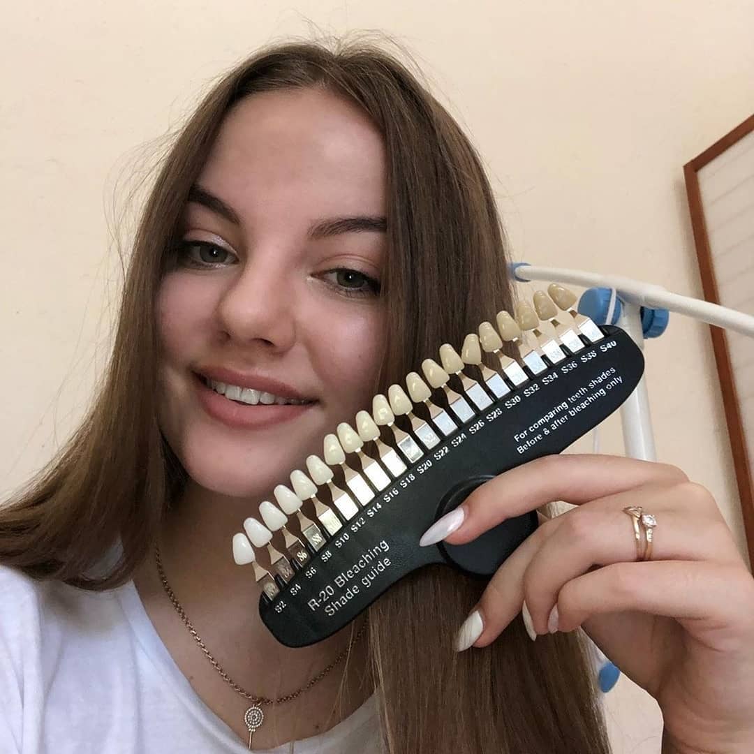 Отзыв на отбеливание зубов от @livealenaa 24 августа 2019 отзыв на отбеливание зубов от @livealenaa